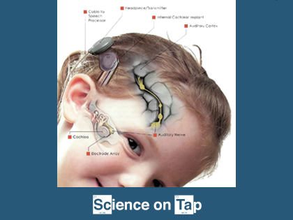Science on Tap: Hybrid Cochlear Implants
